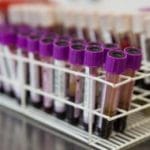 Pesquisadores de SP testam potencial de medicamentos contra novo coronavírus