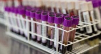 Cientistas de SP investigam moléculas antivirais para tratamento da COVID-19