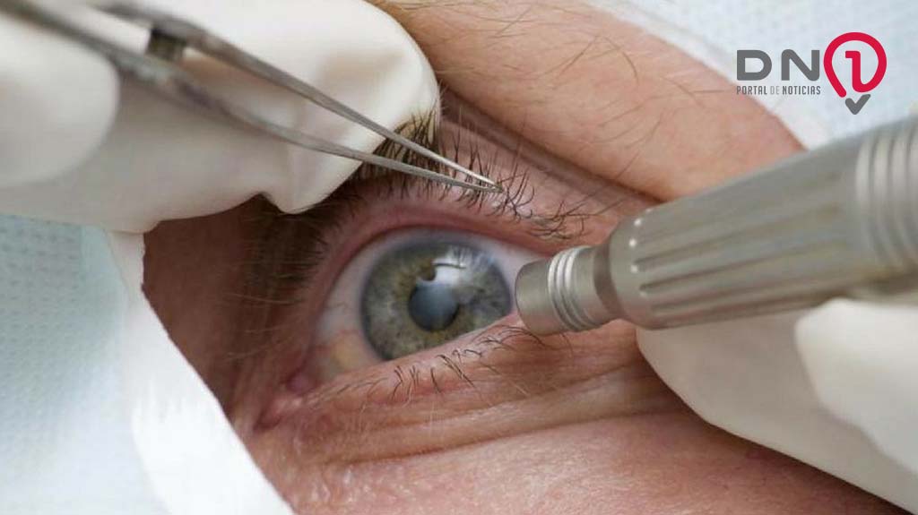 Guia tenta evitar expansão de casos de cegueira por glaucoma